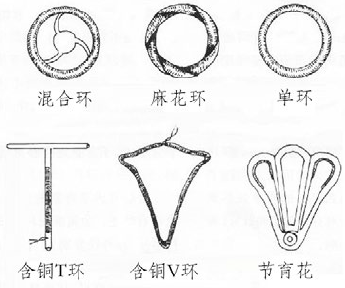 避孕环,节育环,宫内节育器,到底是个啥?