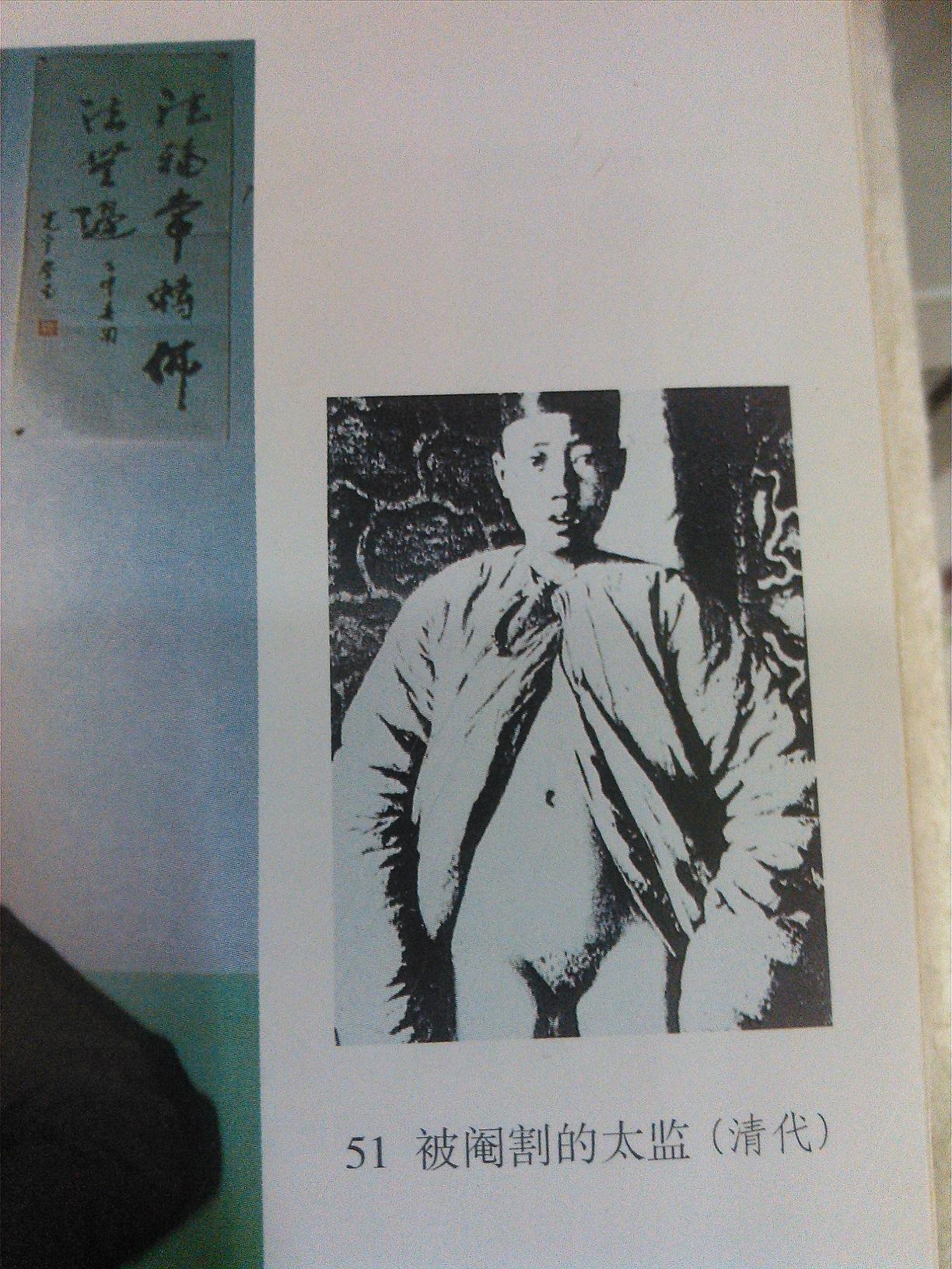 太监是没有睾丸还是没有阴茎? - 知乎