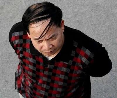 有什么<em>适合秃头男士</em>的帅帅酷酷<em>的发型</em>?地中海