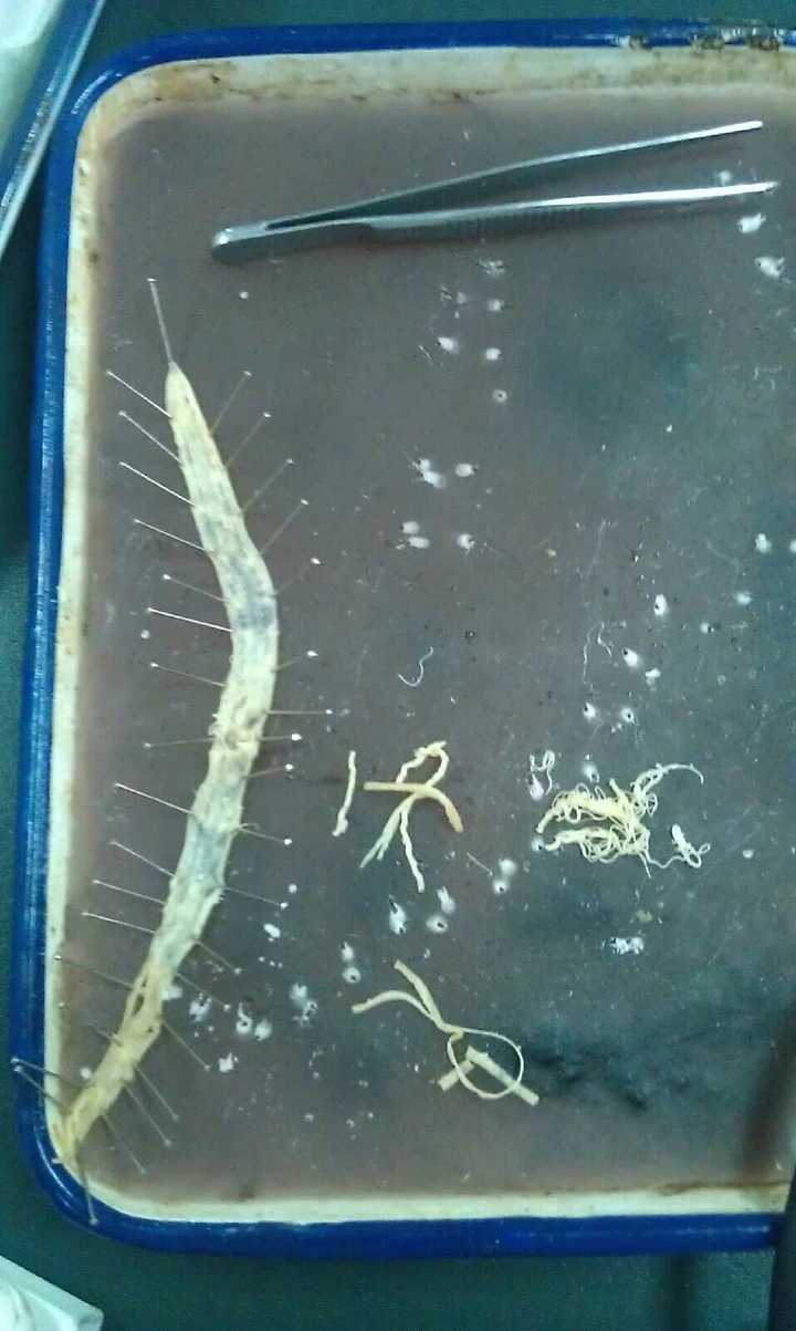 而且,还不止一两条…… 肚子里面有蛔虫,看舌相识可以的,然并卵,给你