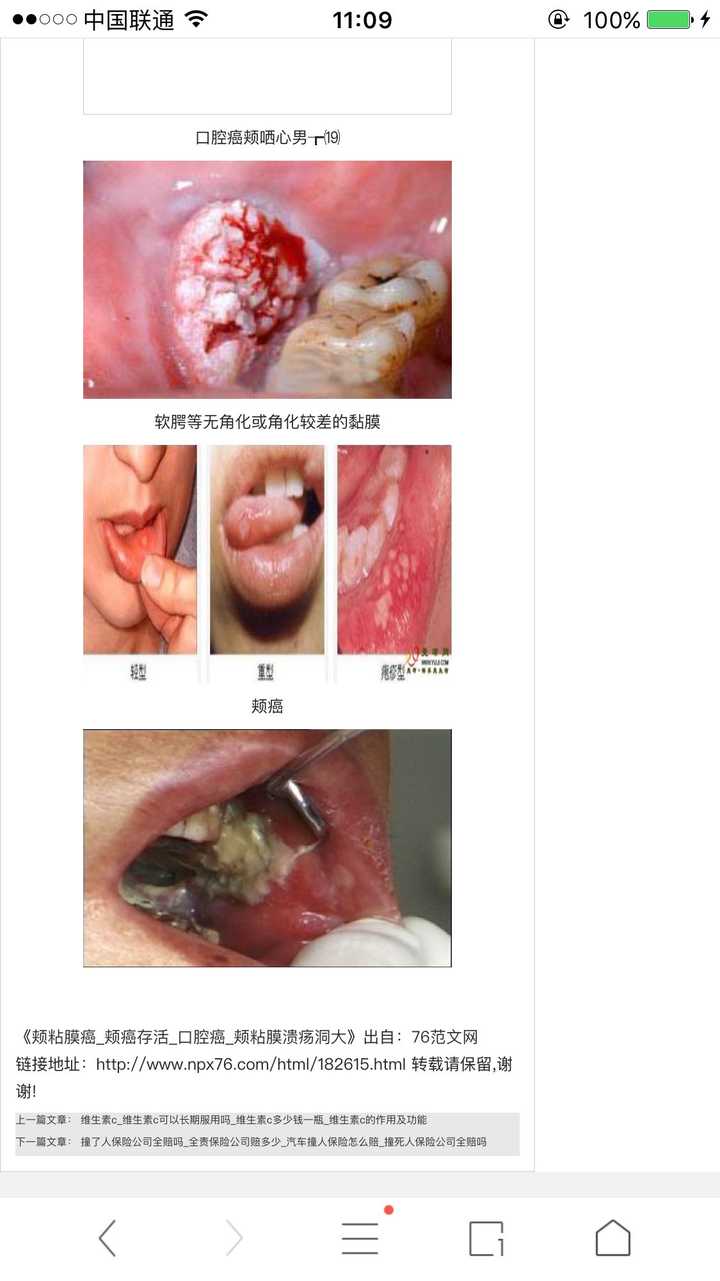 总喜欢用牙齿咬腮帮里的肉,是咬颊症吗?