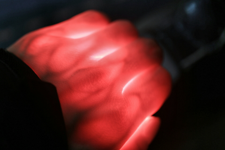 用手包住灯管,为什么会呈红色?红色中间的阴影是骨头吗?