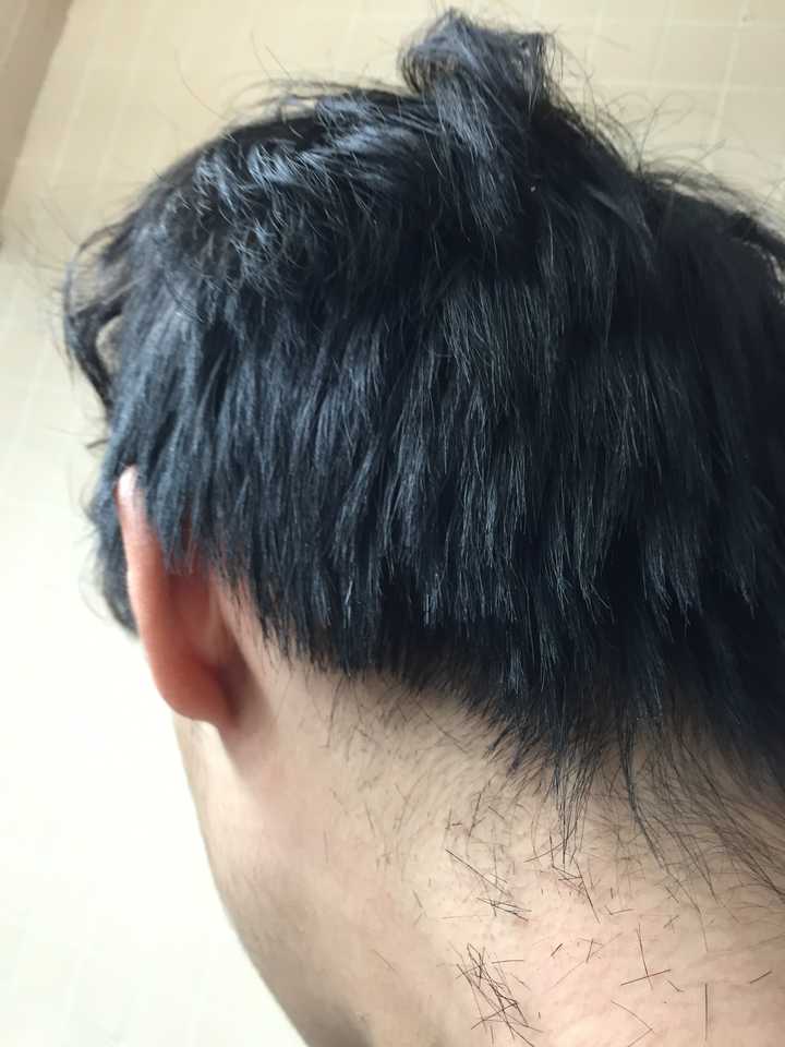 男生怎么样才能留长头发?