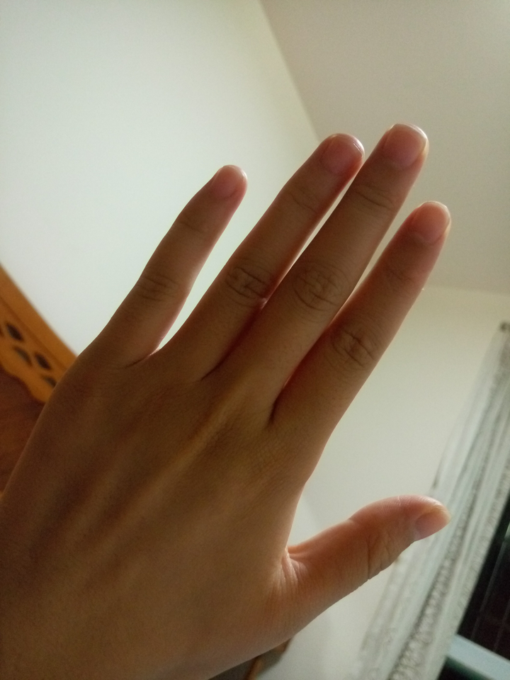 手难看成这样有办法变好看吗(_)手指太粗总是显得手小 减肥可以瘦手指