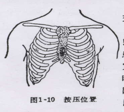 1按压部位:按压患者胸骨中下三分之一或者两乳头连线中点(图黑色区域)