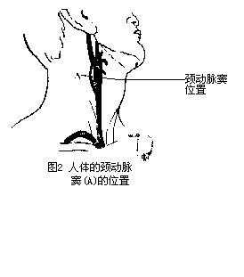 颈动脉窦在这里 当然很可能造成快速死亡喽(事实上,很多以命相搏的