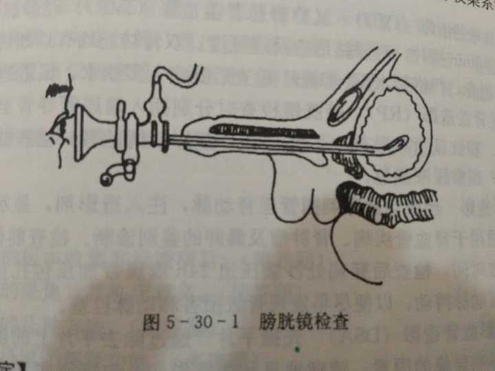 明明只是想劝他少抽烟,说到尼古丁沉积导致膀胱癌变,要做局部化疗