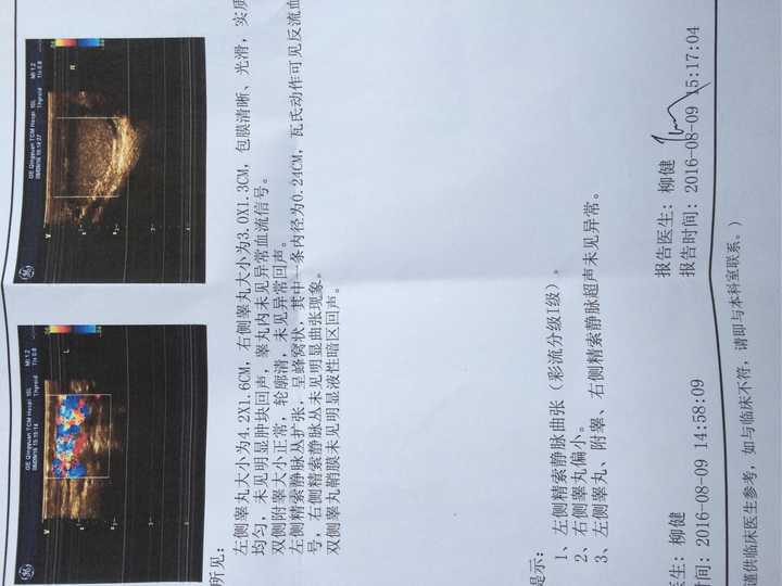 我这个精索静脉曲张严重吗?