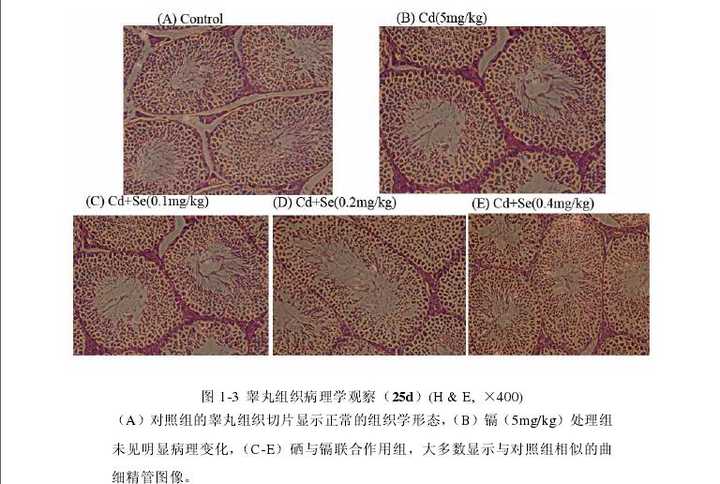 来源《三聚氰胺单独或与三聚氰酸协同对雄性小鼠血睾屏障的影响》