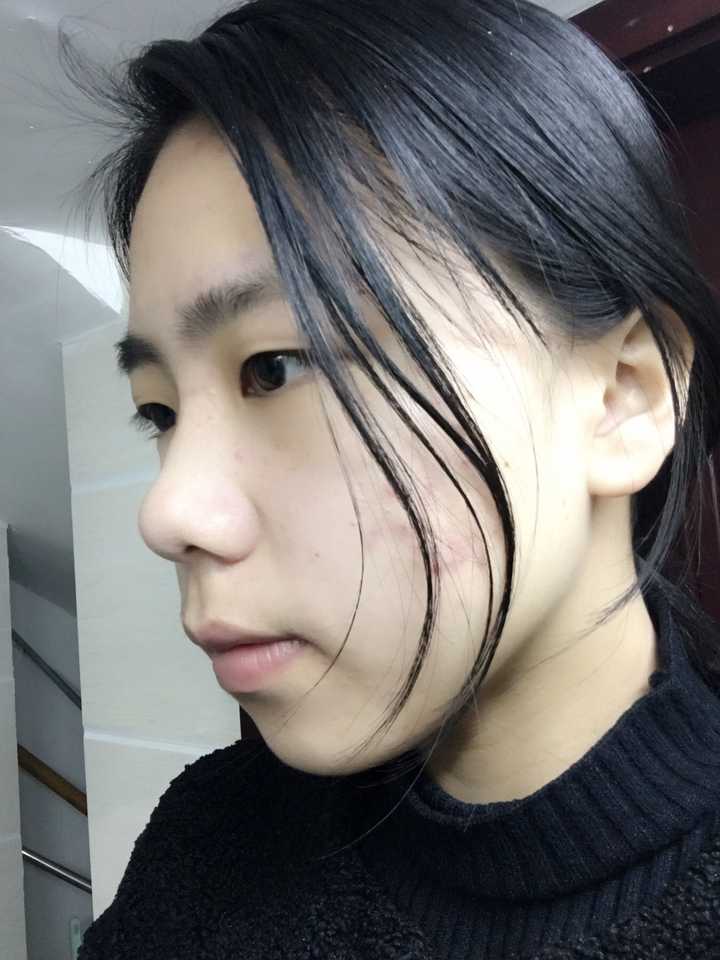 鼻子塌的女孩怎样由丑变美?