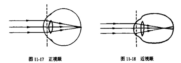 为什么近视眼的人眯眼就可以看得更清楚?