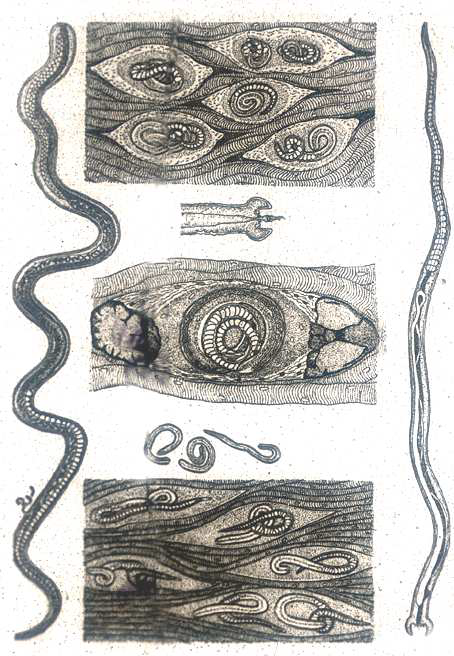 19世纪寄生虫学家笔下充满伊藤润二画风的旋毛虫
