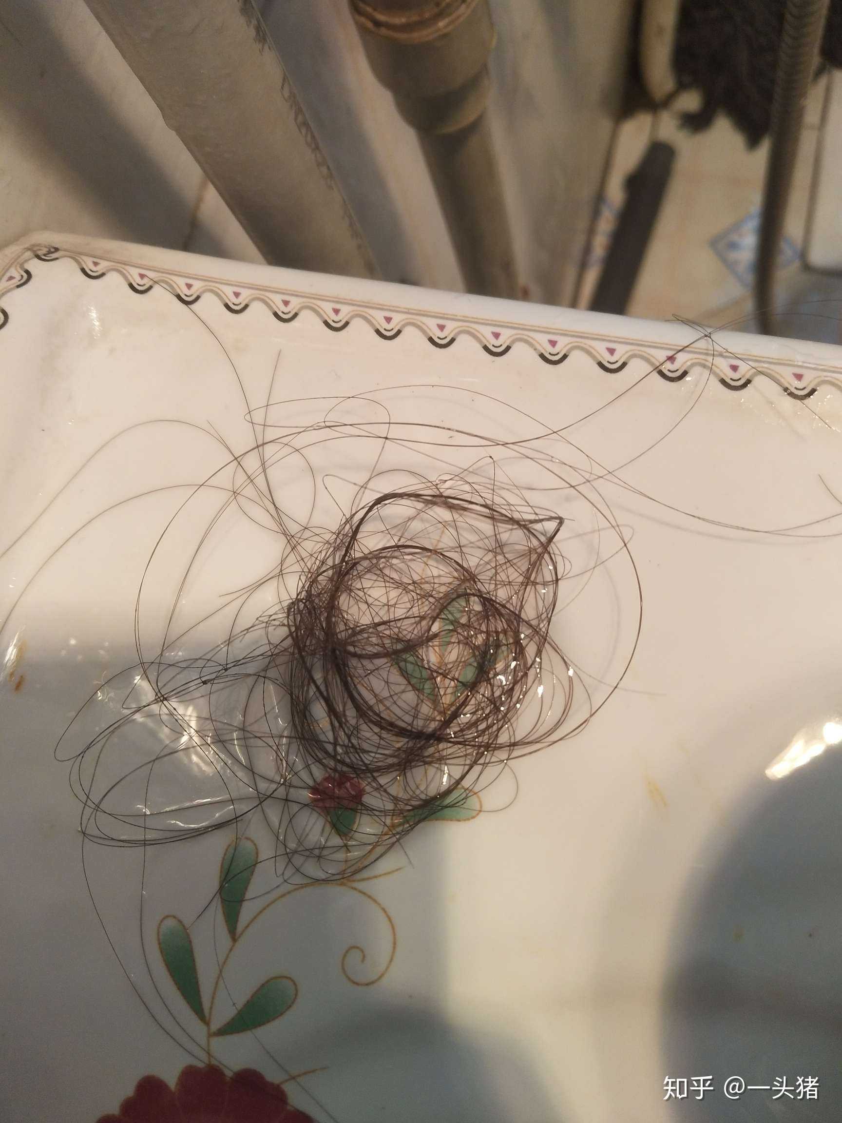 求救求救  掉头发越来越多   中药喝了半个月    吃了很多了   西药也