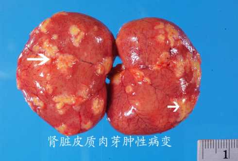 患干性猫传染性腹膜炎案例,开腹探查见肾脏表面肉芽肿性病变.