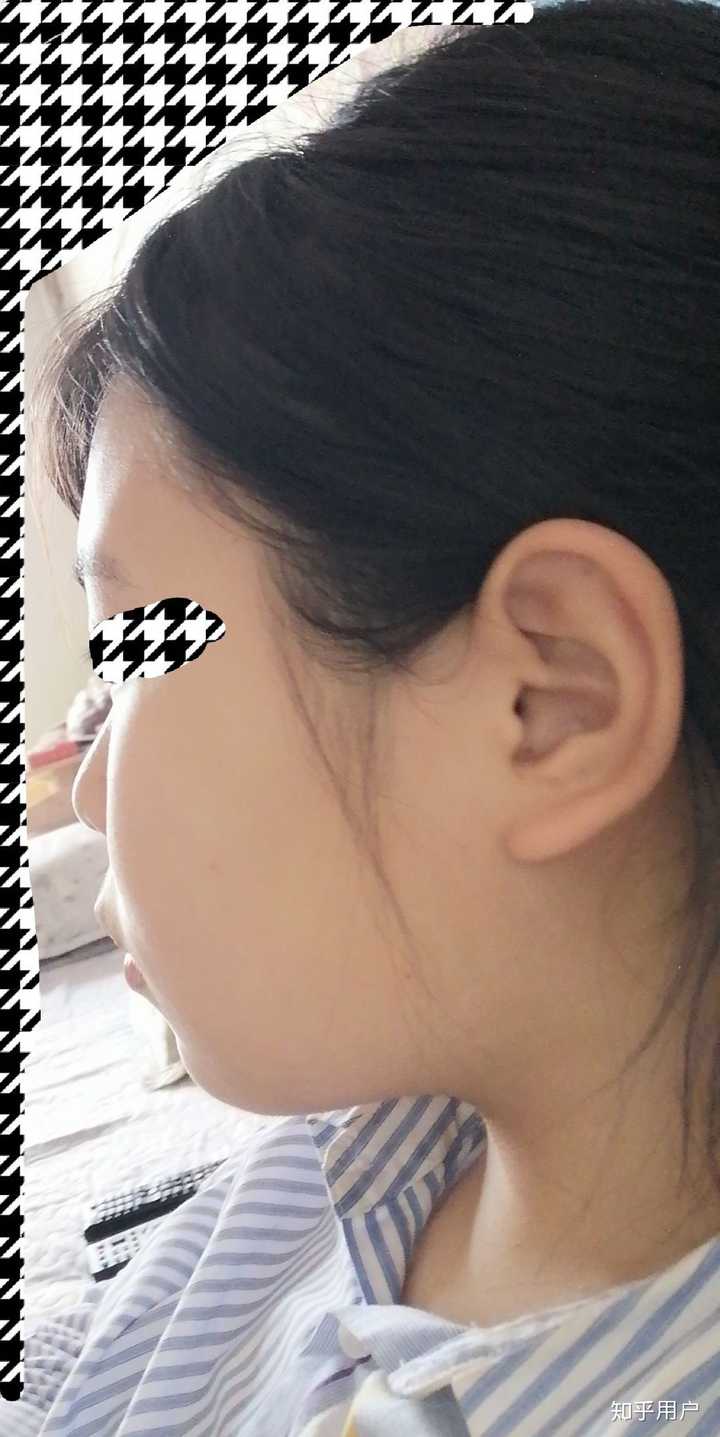女生长得特别丑怎么办?