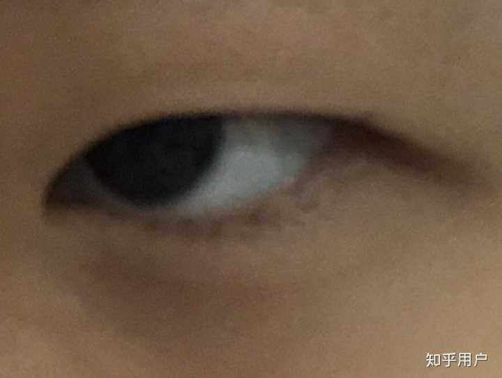 emmmm我觉得我是哈 加上自己是单眼皮 就有一种……死鱼眼?