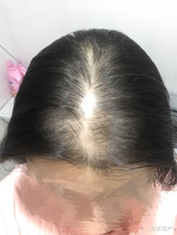 女生头发少是一种怎样的体验?