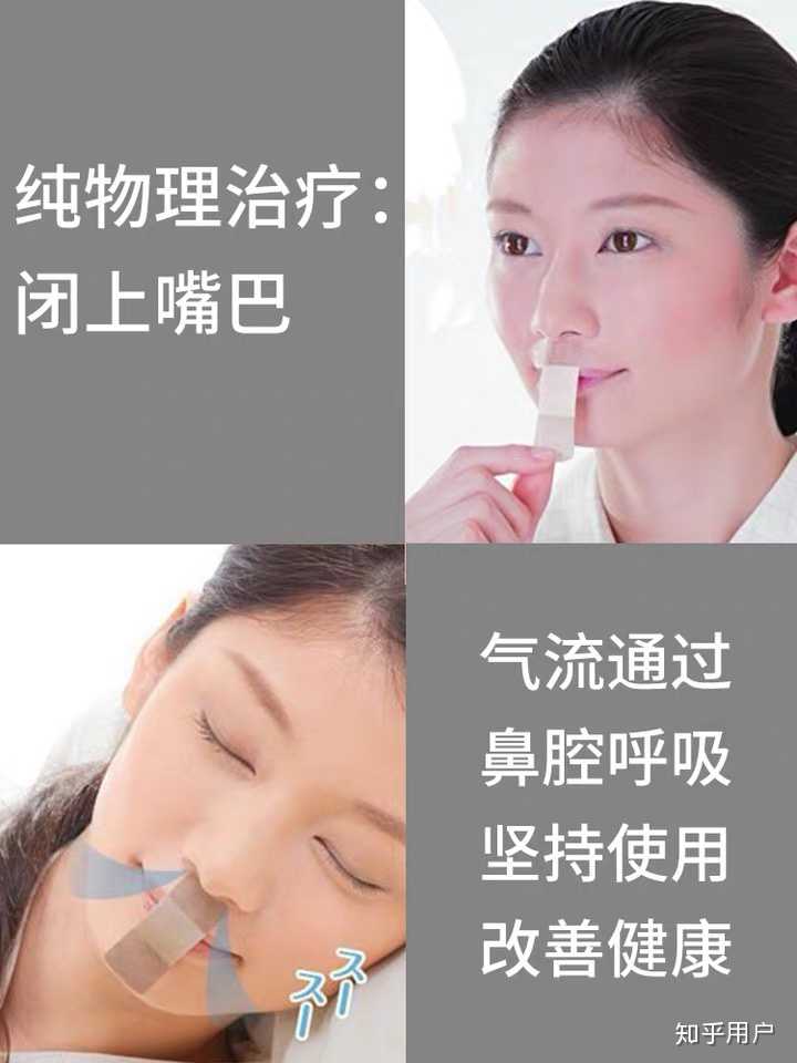 张嘴呼吸面容变丑能恢复么?