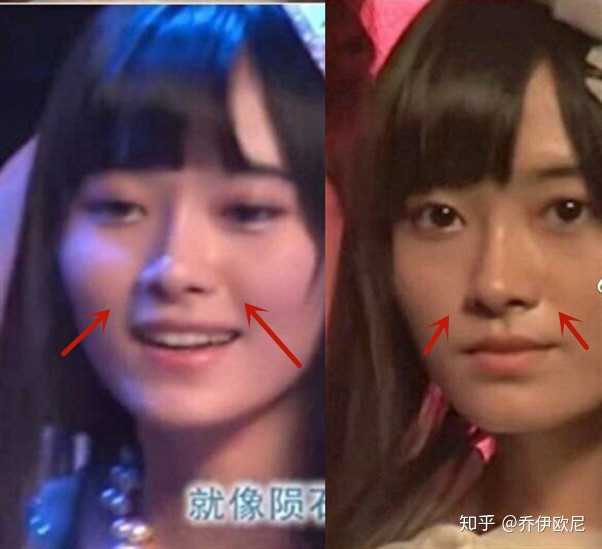 鞠婧祎真的整容了吗