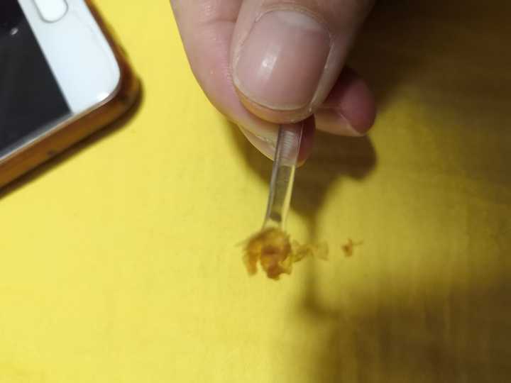 掏出一块超大耳屎是种什么体验