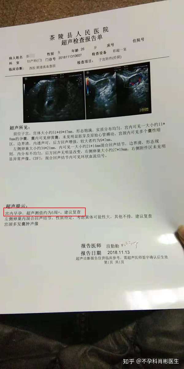 输卵管#