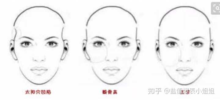 颧弓外扩和颧骨外扩有什么区别啊?