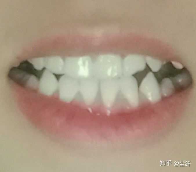外人是怎么看待地包天的呢?