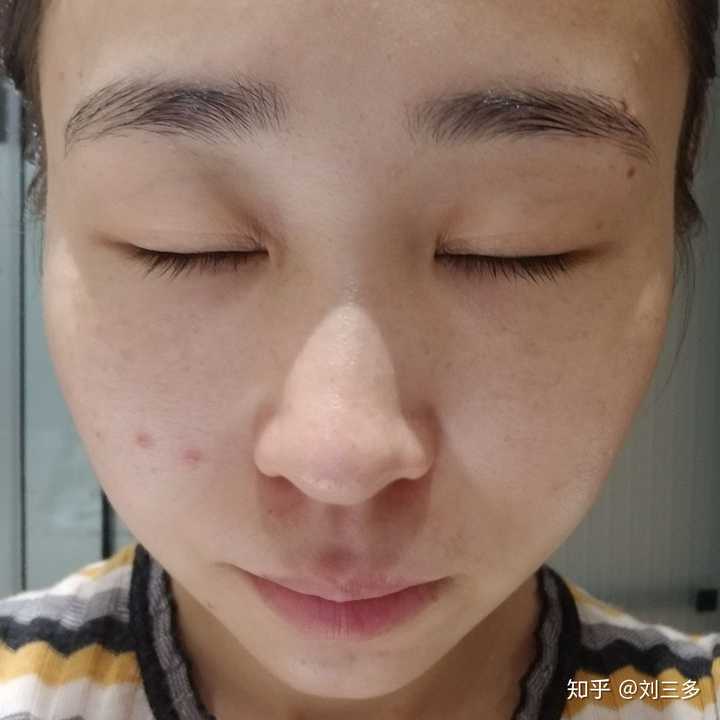 真的感觉脸一下子干净了不少,尤其是之前药水点斑留下的褐色疤,基本