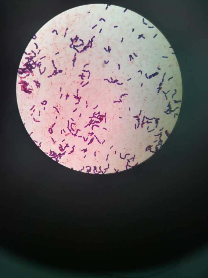 比较典型的,霉菌观察,比较简单,不用做染色.