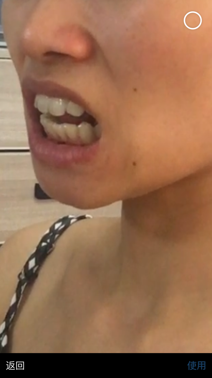 你现在拔牙了吗?