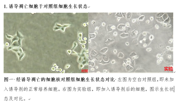 giemsa染色后怎么样的算是凋亡细胞?