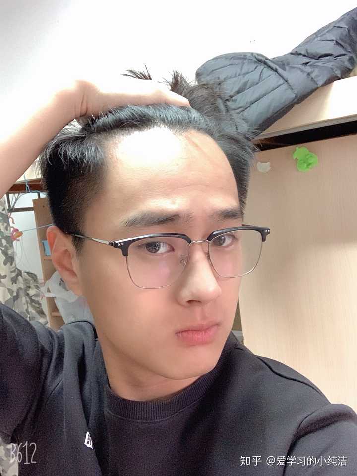 发际线很高的男人适合什么样的发型?