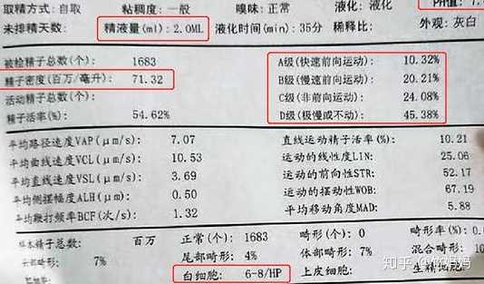 备孕期间,男生检查精子,要注重哪些数据?