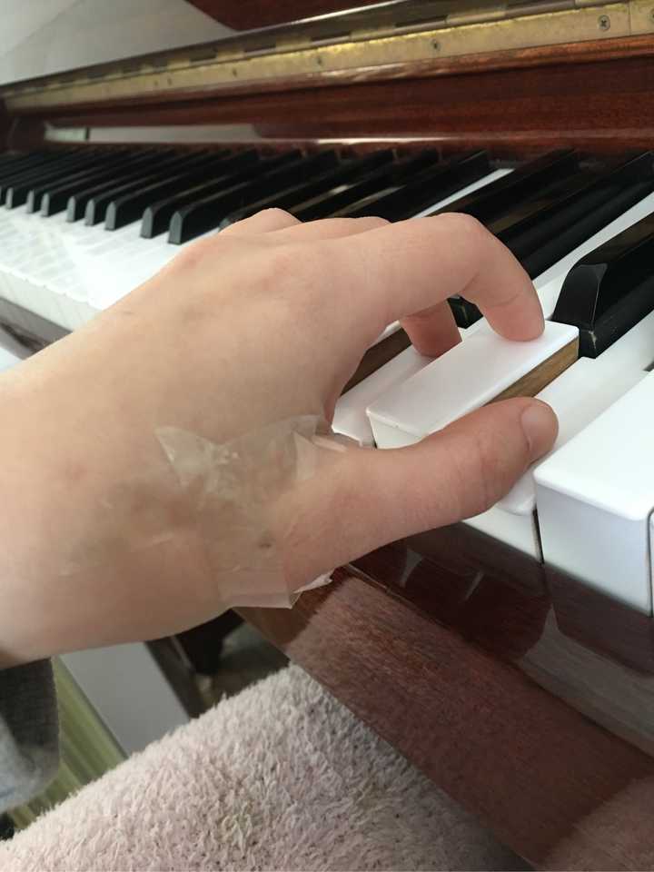 弹钢琴时大拇指关节内陷,如何纠正?