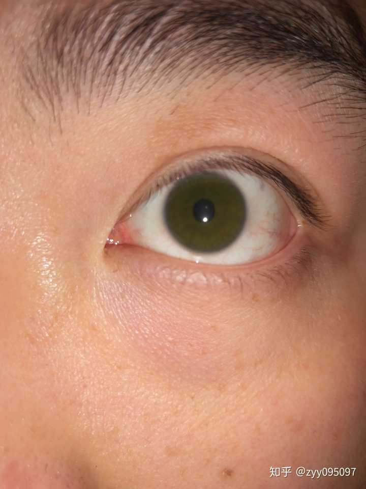 有和我一样天生绿眼睛的中国人么?