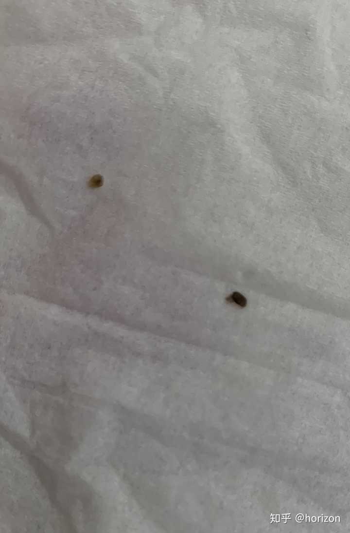 史上最大的黑头有多大?
