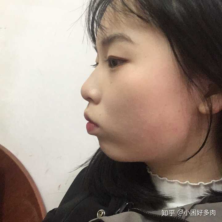 存在凸嘴的美女吗?