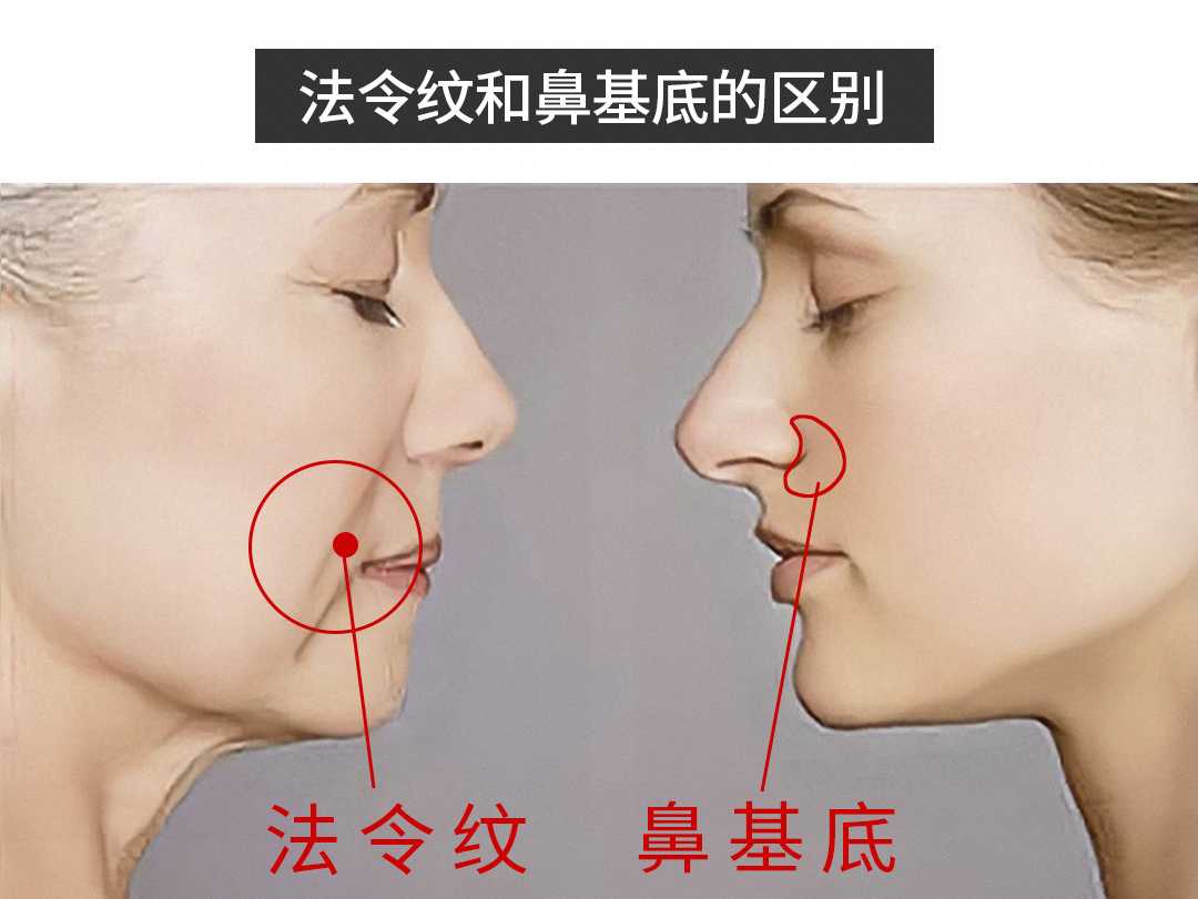 法令纹和鼻基底的区别是什么