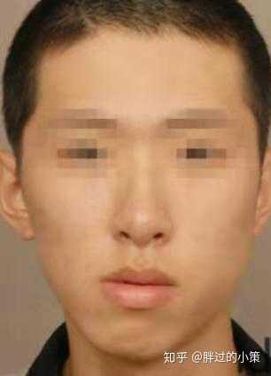 男生怎么瘦脸?