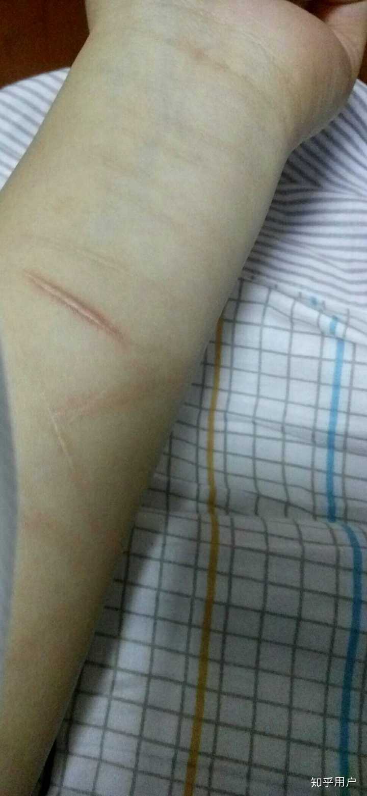 为什么初中生会有自残的行为?