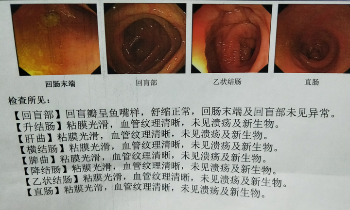 当场就拿了电子肠镜检查报告单(如果肠镜发现有问题的,有的需要一周后