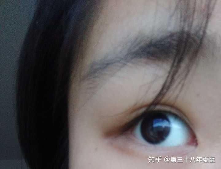 眼尾颜色深是什么情况,这种靠化妆还能拯救吗?
