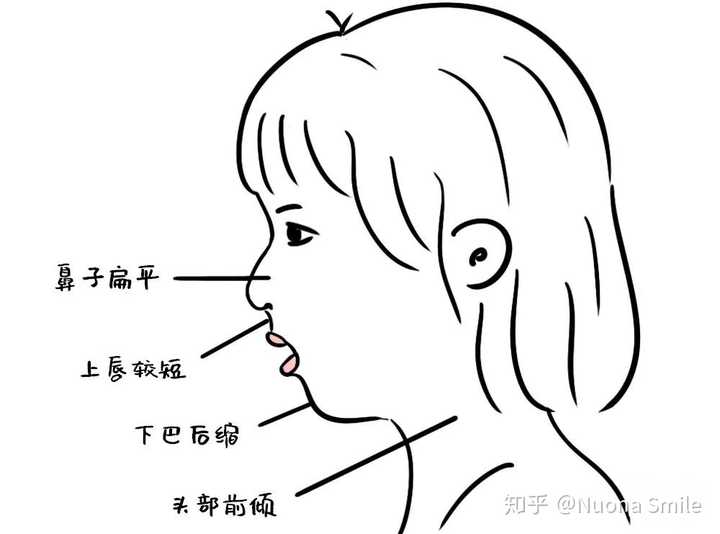用鼻子和用嘴呼吸对脸型真的有影响么?