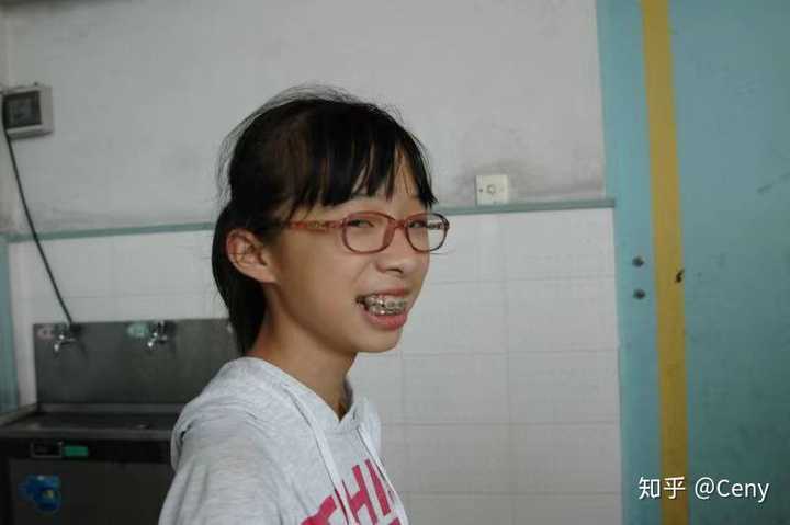 其实小学的时候都没什么自信,因为当时龅牙又戴眼镜,就有了丑女无敌