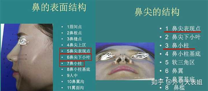 做个小鼻综合多少钱?