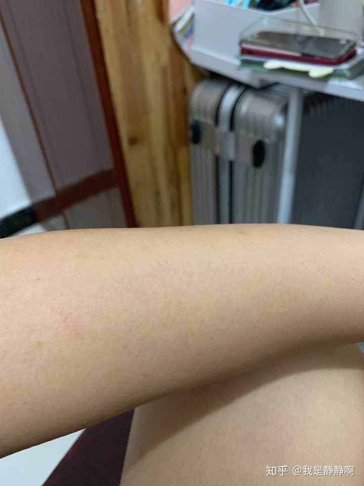手臂上汗毛太长了 我能怎么办 有什么办法去除吗 难顶
