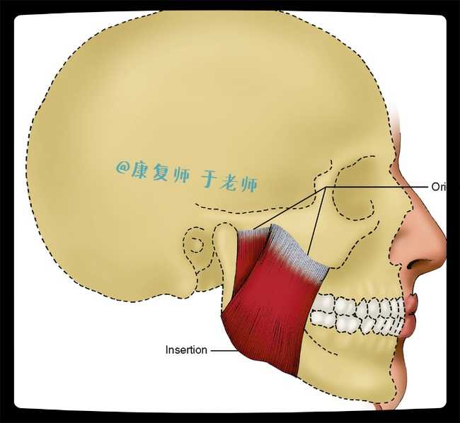颞肌,这块肌肉的解剖是:起于颞窝,呈扇形向下穿过颧弓的深面,止于下颌