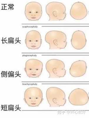 【图2】宝宝头顶部,侧面图