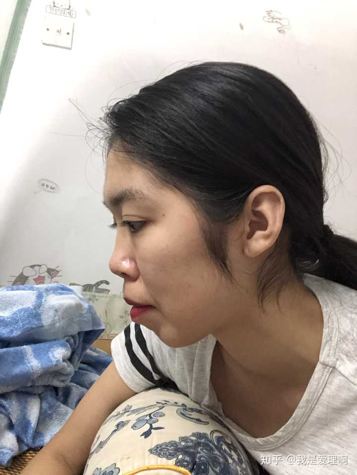 侧脸丑而正脸好看是一种什么体验?
