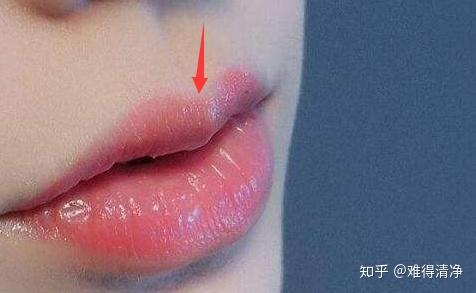 上唇表面: 人中,唇缘弓,唇珠. 下唇表面形态变化小,结构也简单.